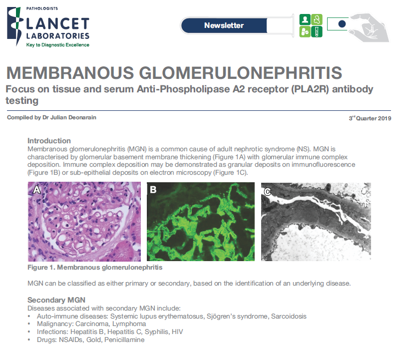 Membranous Glomerulonephritis Lancet Laboratories