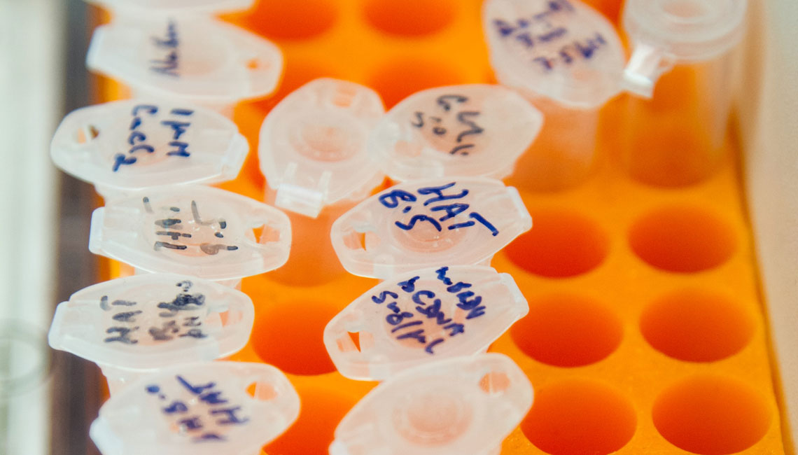 Largest General Diagnostic Campaign Lancet Laboratory