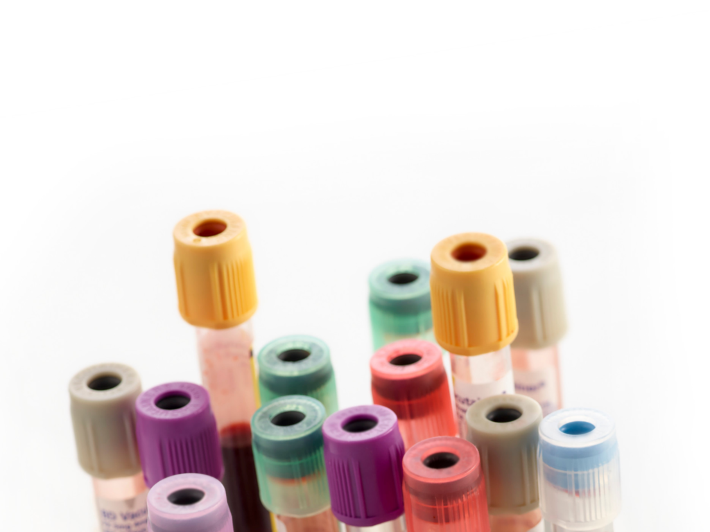 Haematology Lancet Laboratory