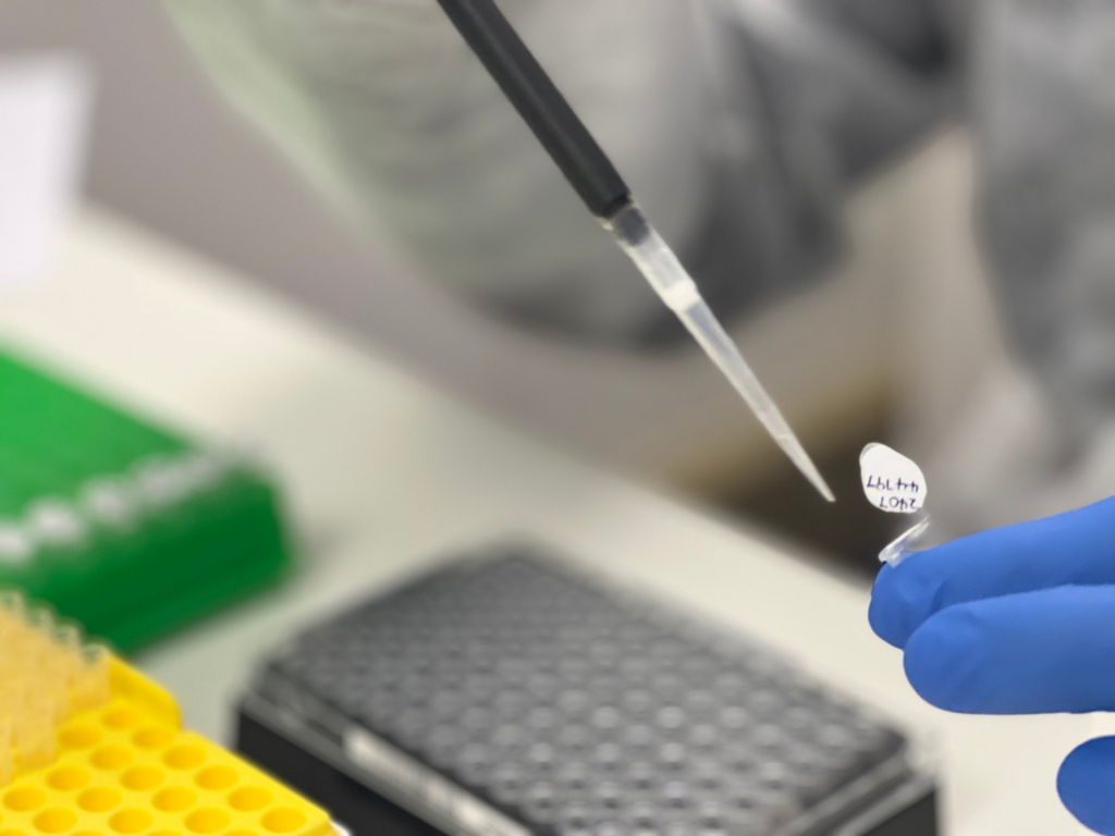 Microbiology and TB Laboratory Lancet Laboratory