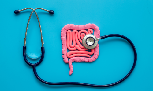 Colorectal Cancer